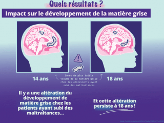 Agrandir l’image